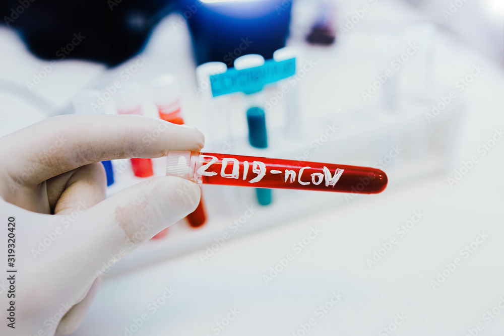 epidemic test and blood in the doctor’s hand coronavirus test tube 2019 - nCoV, appeared in Wuhan, China epidemic test and blood in the doctor’s hand coronavirus test tube 2019 - nCoV, appeared in Wuhan, China