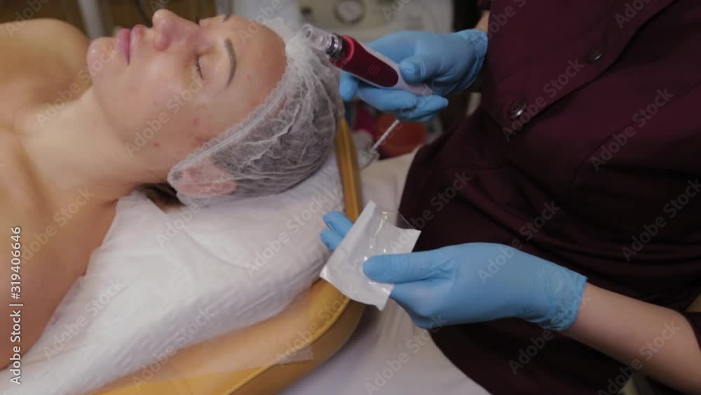 Professional cosmetologist woman connects nozzle to micronidling device. Professional cosmetologist woman connects nozzle to micronidling device.