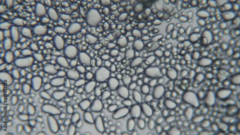 Tapioca Microscope Highly magnified starch granules from a potato. Close up. Potato starch ...