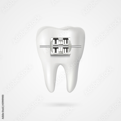 vector tooth braces illustration 3d style