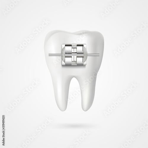 vector tooth braces illustration 3d style