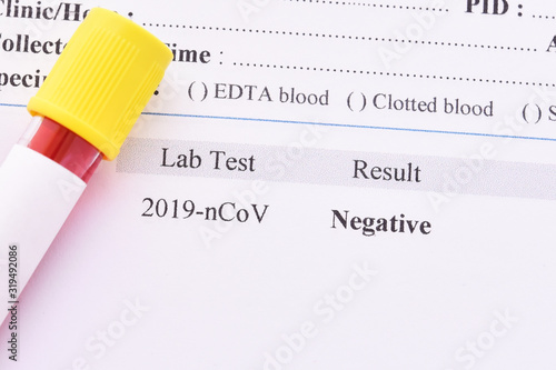 Negative test result of coronavirus 2019 or 2019-nCoV, novel coronavirus found in Wuhan, China