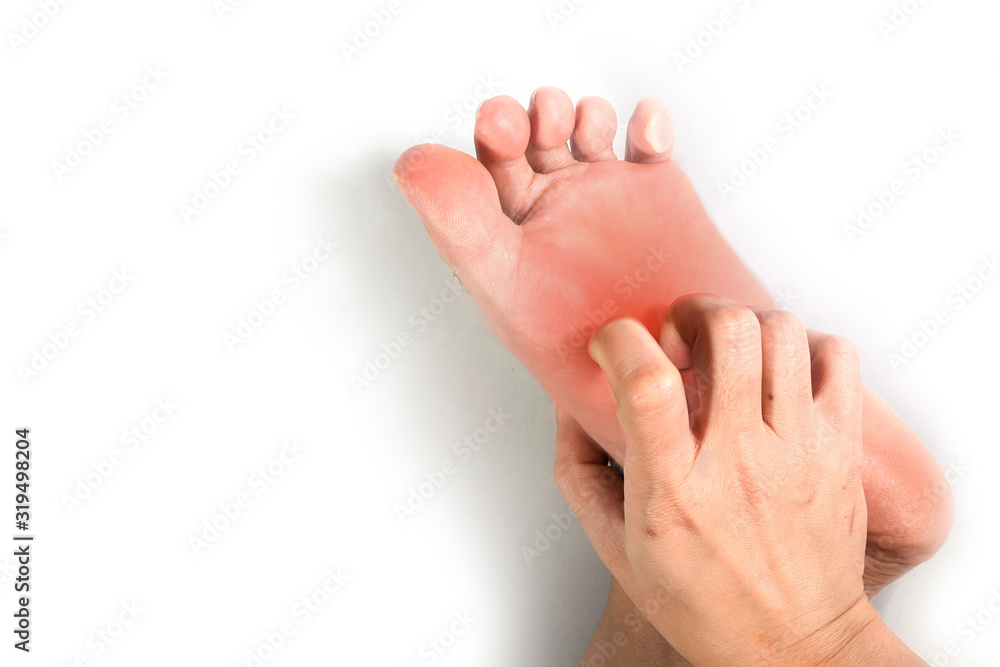 Woman hand scratching on feet with redness rash. Woman hand scratching on feet with redness rash.