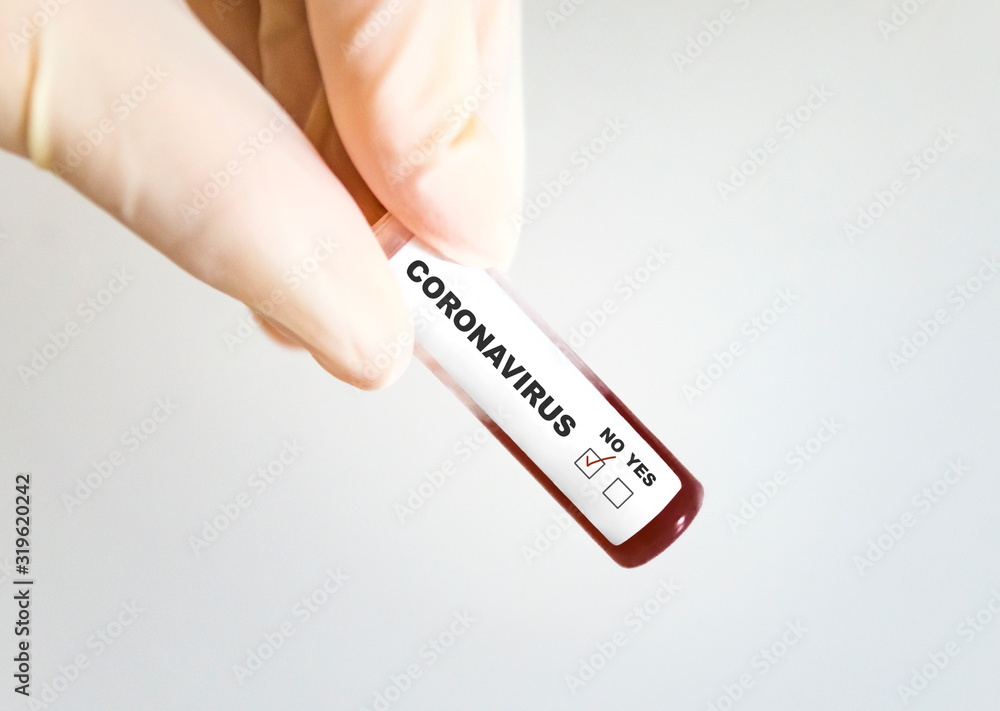 Obraz premium Test tube with blood infected by coronavirus