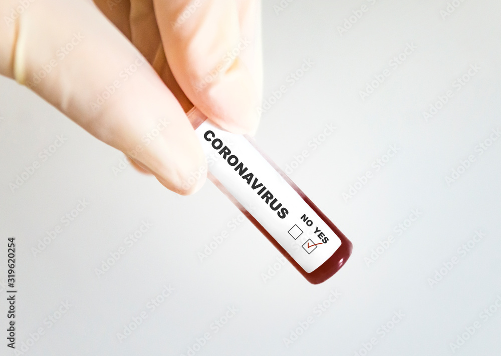 Obraz premium Test tube with blood infected by coronavirus