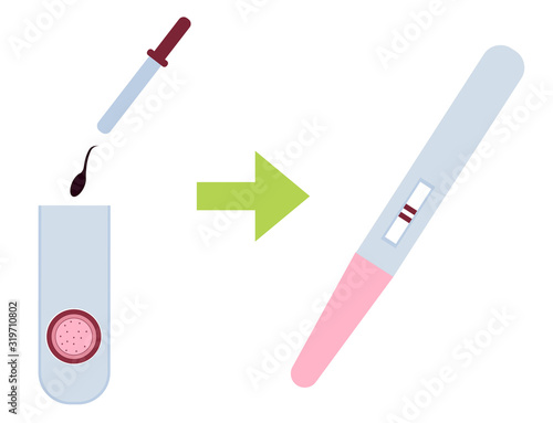 In vitro fertilisation and pregnancy test. Putting sperm in a test tube.