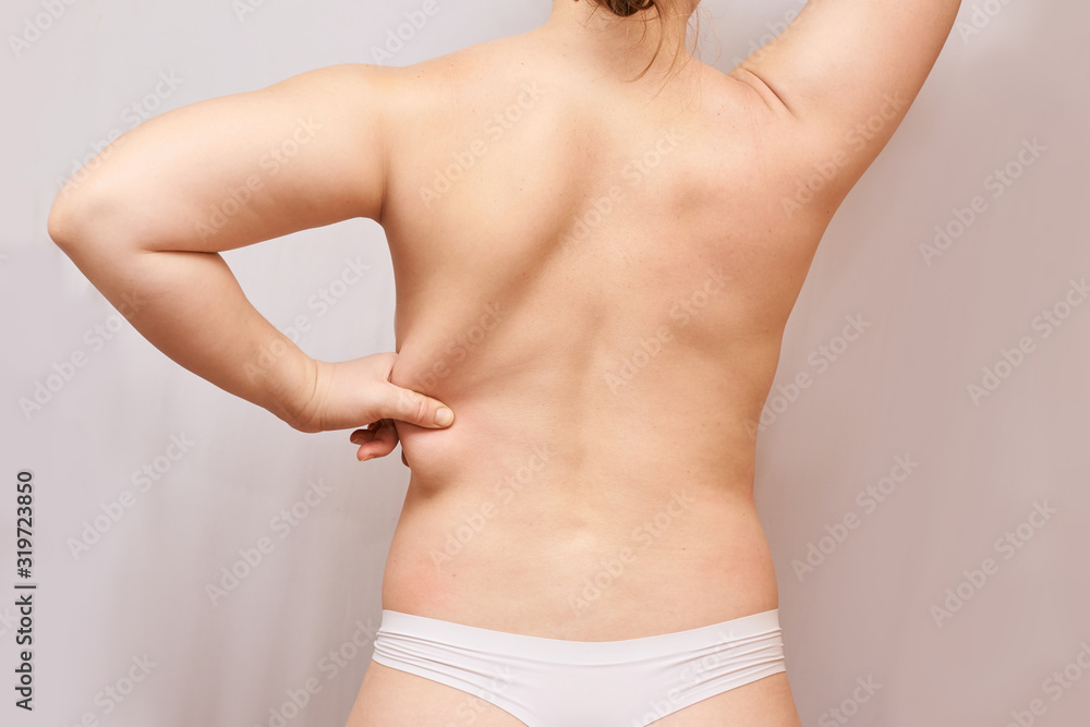 Fat unhealthy woman body. Pinch back side. Measurement lady procedure. Medicine pinching. Anti cellulite overweight
