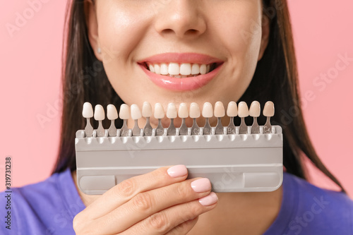 Beautiful young woman with teeth color samples on color background, closeup