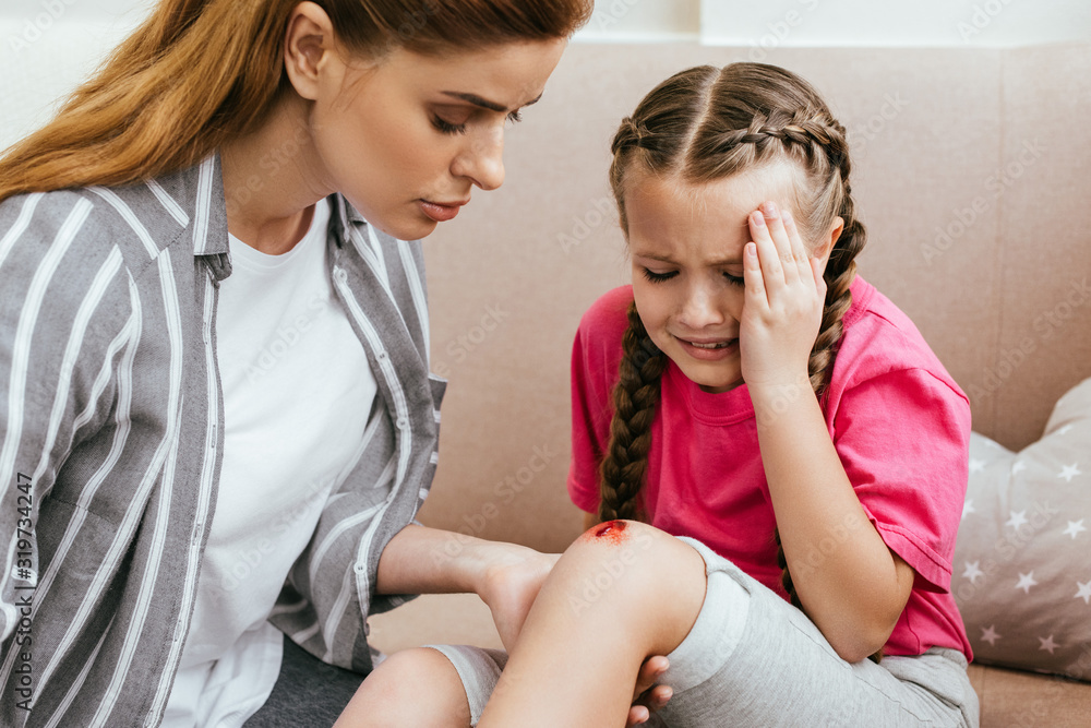 mother holding leg with wound on knee while emotional daughter crying at home mother holding leg with wound on knee while emotional daughter crying at home