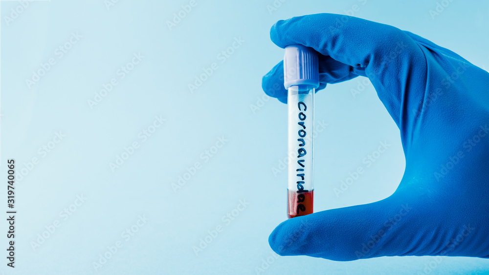 A positive blood test result for a new rapidly spreading coronavirus. concept of medicine and health care A positive blood test result for a new rapidly spreading coronavirus. concept of medicine and health care