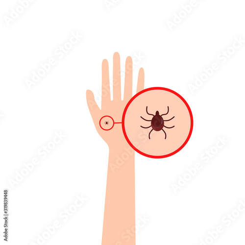 hand with a tick under a magnifying glass