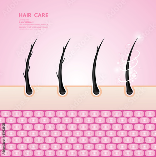 Hair problem and hair protect and care technology concept vector illustration.