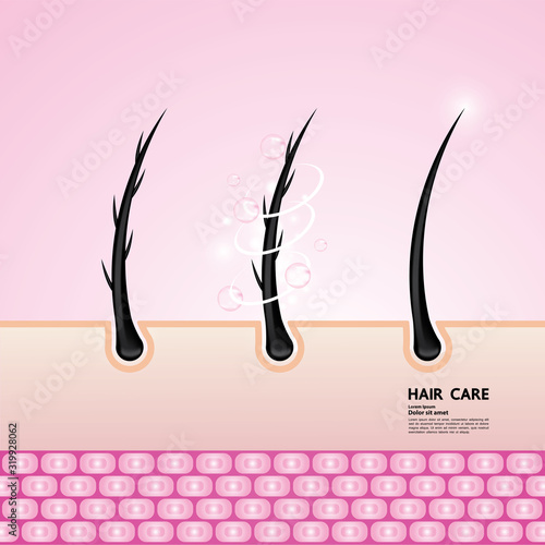 Hair problem and hair protect and care technology concept vector illustration.