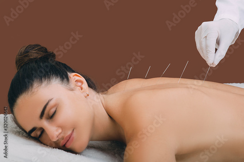 woman relaxes from acupuncture procedure. An acupuncturist doong acupuncture very accurately. Traditional chinese medicine