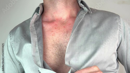 Caucasian man taking off blue shirt
