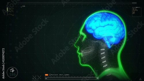 Patient's brain scan test results on screen, disease diagnostics and prevention