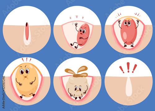 Different stages and emotions of acne