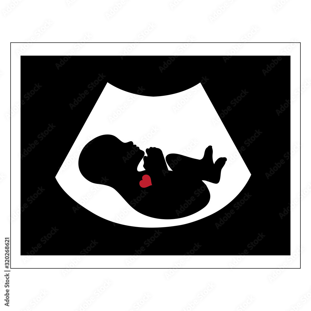 Vector silhouette of fetus ultrasound on white background. Symbol of ...