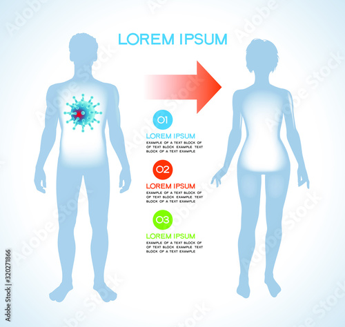 Virus. Modern medical infographics. Coronaviruses in a human body. Anatomy of people