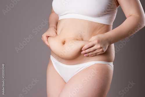 Obraz na płótnie Tummy tuck, flabby skin on a fat belly, plastic surgery concept