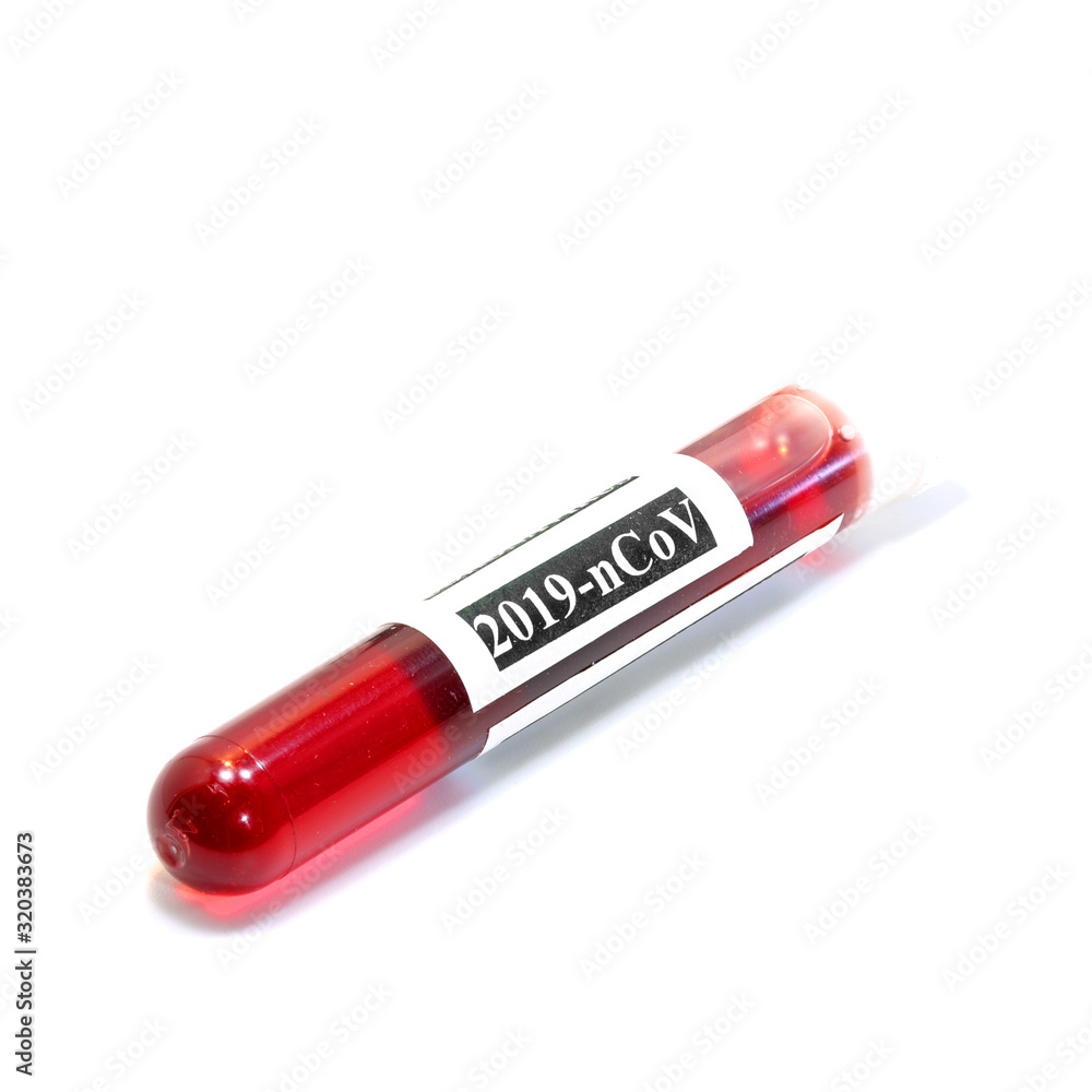 test tube with blood infected with coronavirus in analysis labor test tube with blood infected with coronavirus in analysis labor