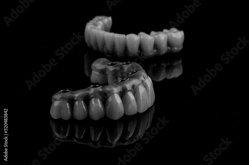 dental implants on a black background