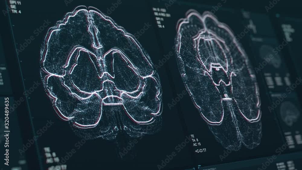 Brain scan screen animation. The device scans and displays vital signs. Neurology data. Diagnosis of diseases. The future of MRI video. 4K footage with Depth of Field effect