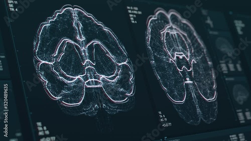 Brain scan screen animation. The device scans and displays vital signs. Neurology data. Diagnosis of diseases. The future of MRI video. 4K footage with Depth of Field effect