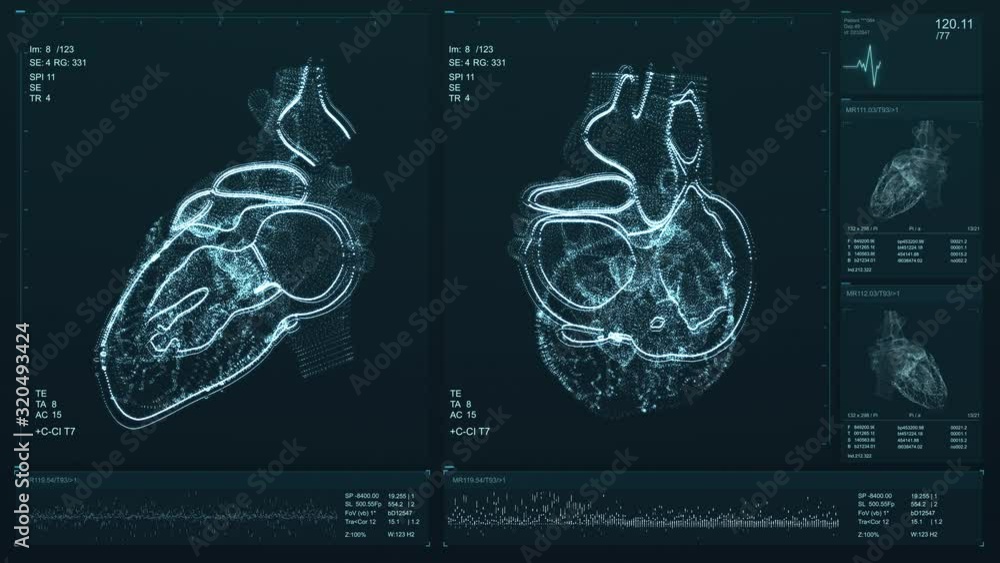 Video Stock Heart scan screen animation. Blood pressure and heart rate ...