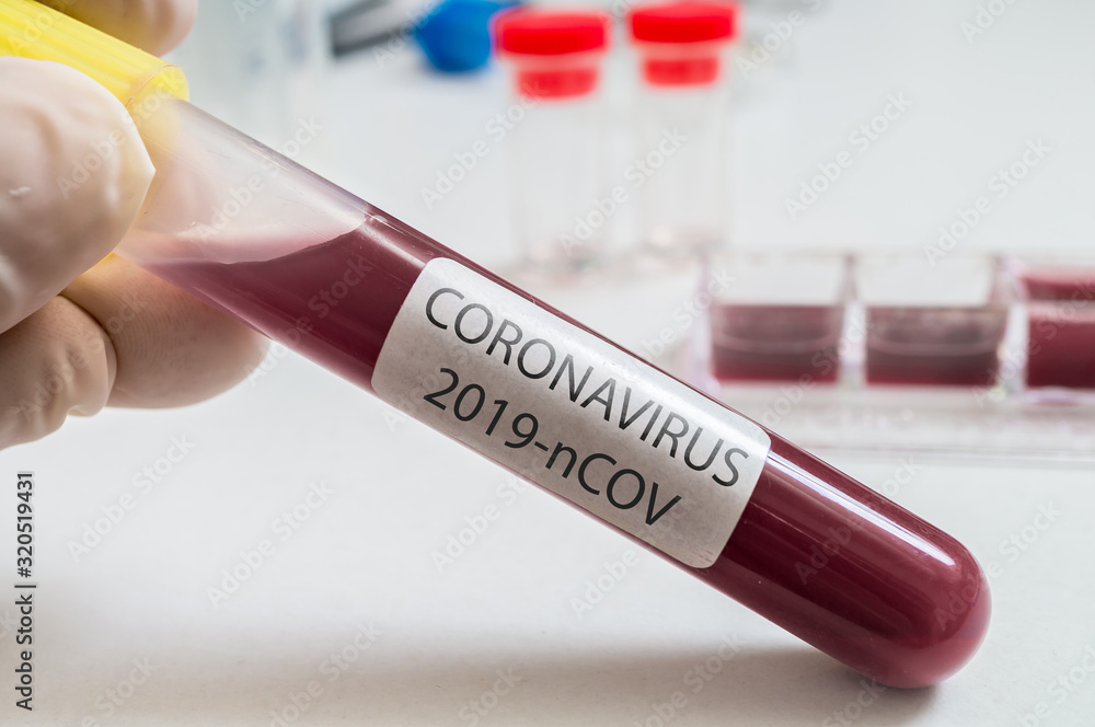 Hand holds test tube for Coronavirus 2019-nCOV analysis. Hand holds test tube for Coronavirus 2019-nCOV analysis.