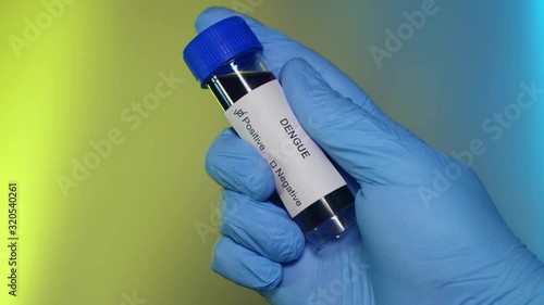 Positive Blood Test Tube Dengue Fever Infection Outbreak Epidemic