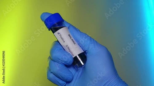 Positive Blood Test Tube Malaria Virus Infection Outbreak Epidemic