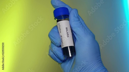 Negative Blood Test Tube Malaria Virus Infection Outbreak Epidemic