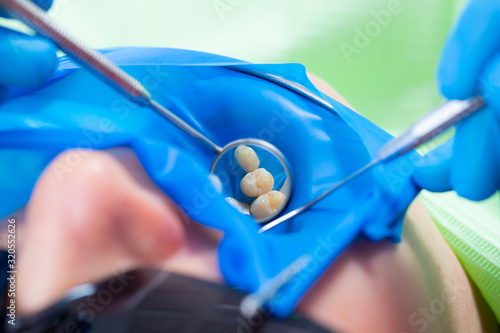 Close-up latex plate designed to isolate the tooth to be treated from the rest of the oral cavity during treatment. photo