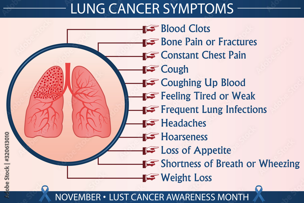 Lung cancer symptoms infographic vector illustration. Health ...