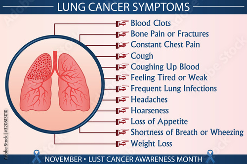 Lung cancer symptoms infographic vector illustration. Health, healthcare, and november lung cancer awareness month concept for presentation, brochure, banner etc. Eps 10 format with printable colors.
