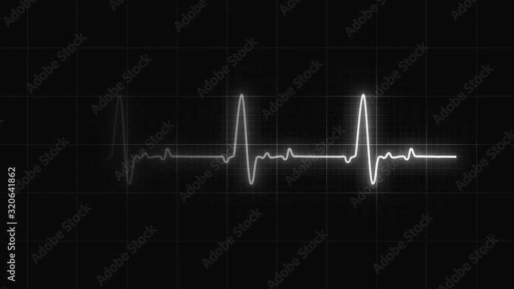 Glowing Monochrome heart rate or heart beat line. Cardiogram signal monitoring process. Isolated on black. Patient’s vital signs. Medical and science 4K footage. Cardiology indicator. Electocardiogram Glowing Monochrome heart rate or heart beat line. Cardiogram signal monitoring process. Isolated on black. Patient’s vital signs. Medical and science 4K footage. Cardiology indicator. Electocardiogram