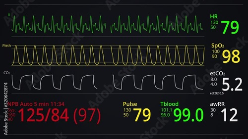 Monitoring patient Vital signs. Heart rate or heart beat, oxygen saturation, respiration indication. ICU monitor or display in hospital. Medical and science clip. Cardiogram footage. EKG, ECG screen.