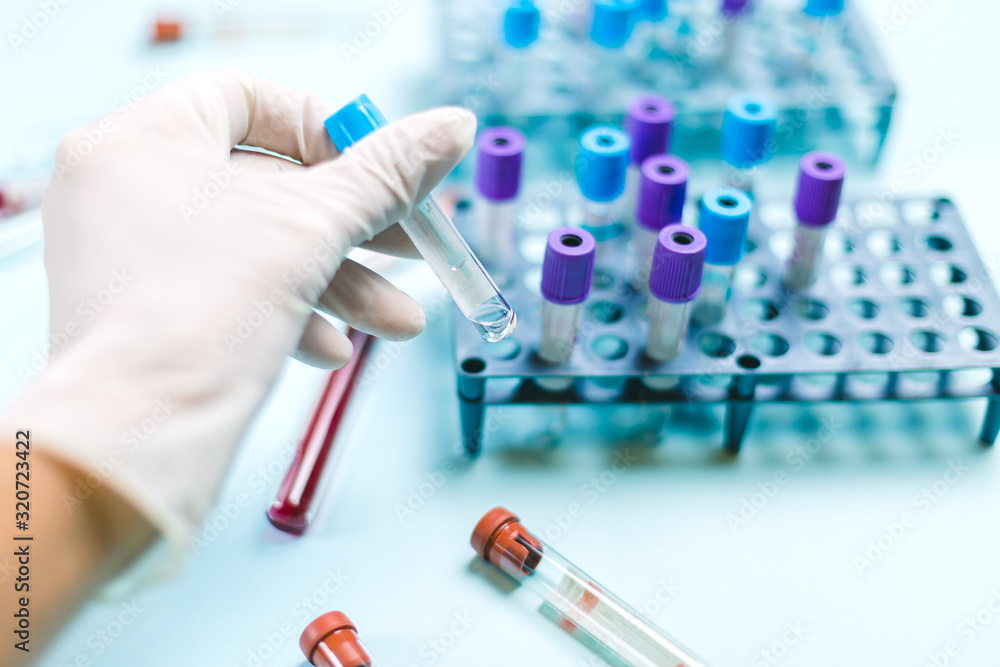 Doctor with medical glove handling a vial with medical samples in the analysis laboratory Doctor with medical glove handling a vial with medical samples in the analysis laboratory