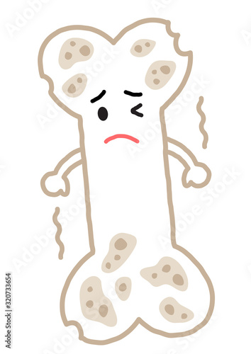 骨粗鬆症　弱い骨