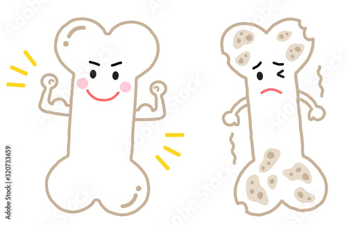 強い骨と弱い骨