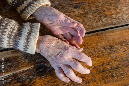 Old women, sickly hands on a wooden table. Rheumatoid arthritis, osteoarthritis. Medicine. Chronic disease. 