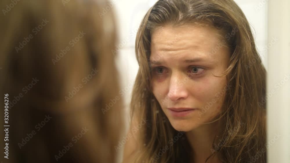 A woman with bruises and scars in her face from being punched and hit looks herself in the mirror crying and touching her sore wounds on her cheek. A woman with bruises and scars in her face from being punched and hit looks herself in the mirror crying and touching her sore wounds on her cheek.
