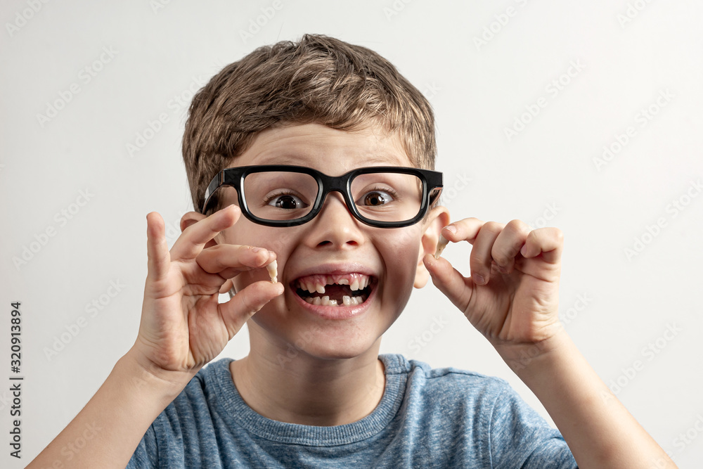 Handsome toothless boy wearing eyeglasses, smiling shows us two fallen teeth Handsome toothless boy wearing eyeglasses, smiling shows us two fallen teeth