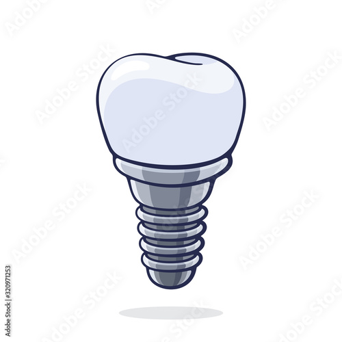 Vector illustration. Dental implant of human tooth. Fixture prothesis in dentistry. Symbol of somatology and oral hygiene. Graphic design with contour. Isolated on white background
