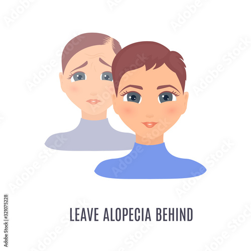 Leave alopecia behind inspirational quote. Front view portrait of a woman before and after hair treatment and transplantation. Beauty health care concept. Vector illustration.