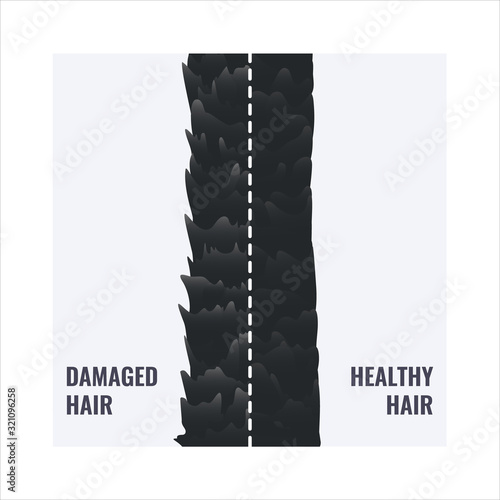 Damaged and healthy hair under the microscope. Hair follicle surface condition closeup. Trichology before and after medical concept. Vector illustration.
