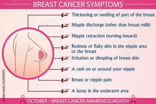 Breast cancer symptoms infographic vector illustration. Health, healthcare, and october breast cancer awareness month concept for presentation, brochure, banner. Eps 10 format, printable colors.