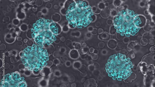 Coronavirus infezione delle cellule viste al microscopio del laboratorio photo