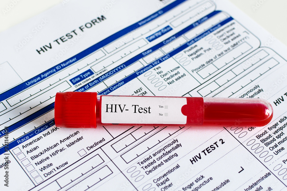 Red blood vial with blood sample over HIV test form background. Red blood vial with blood sample over HIV test form background.